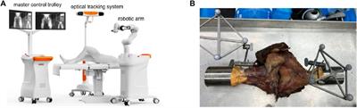 Robotic-assisted anatomic anterior cruciate ligament reconstruction: a comparative analysis of modified transtibial and anteromedial portal techniques in cadaveric knees